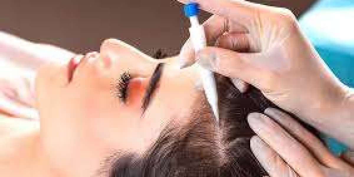 Al Borj Aesthetics in Dubai offers FUE hair transplants