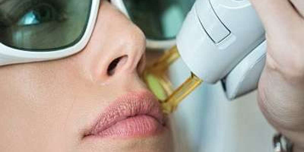 Laser Hair Removal: For Flawlessly Smooth Skin