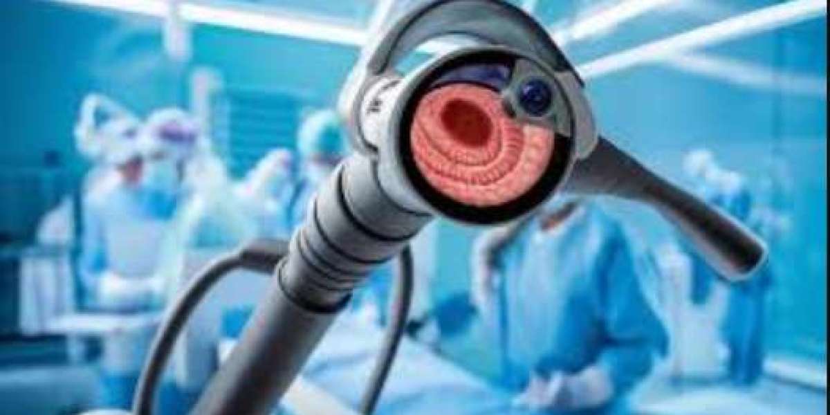 Flexible Endoscopes Market Report 2024-2032: Industry Trends, Segmentation & Forecast Analysis