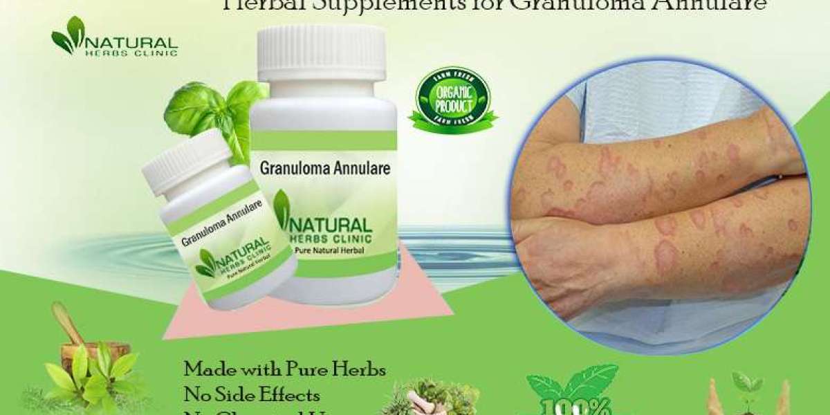 Natural Supplements for Granuloma Annulare: The Secret to Healthier Skin