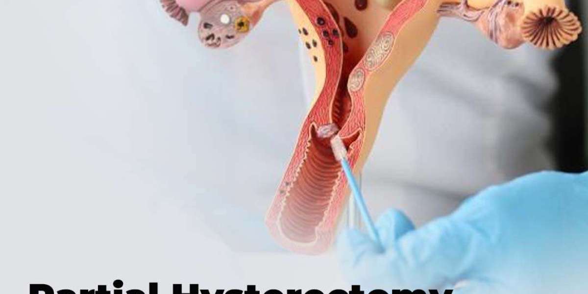 The Essential Guide to Partial Hysterectomy Surgery by Reclaim Specialist