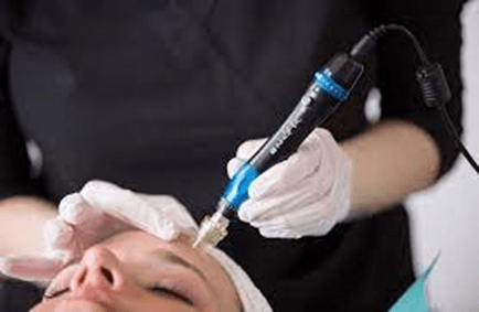 Microneedling: Benefits For All Skin Types - Microneedl...