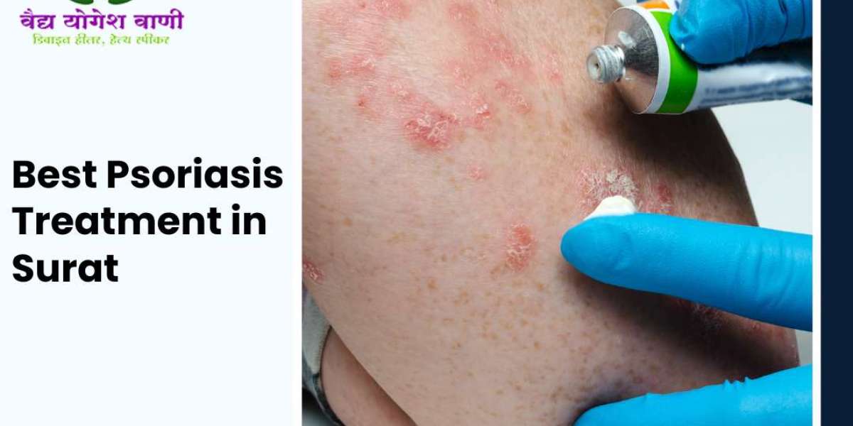 Best Psoriasis Treatment in Surat: Your Path to Clear Skin with Vaidya Yogesh Vani