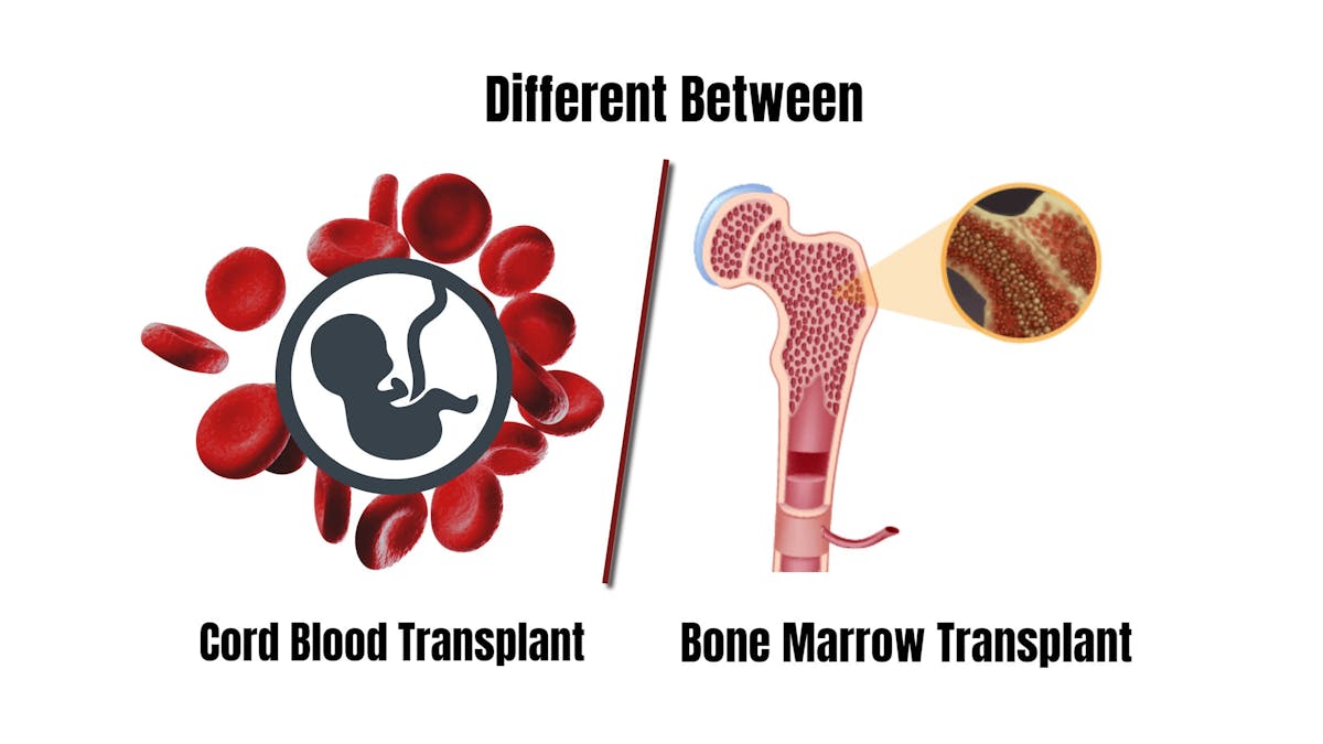 Is Bone Marrow Transplant Different Than Cord Blood Transplant?