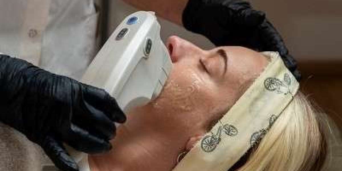 Hifu Treatment in Islamabad: Rejuvenate Your Skin