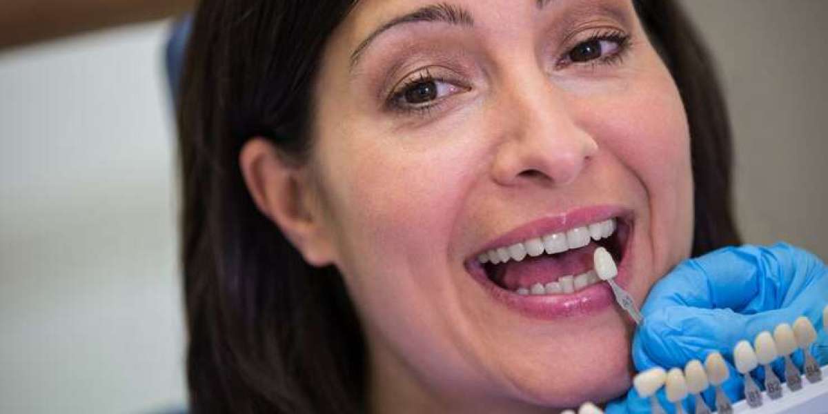 The Future of Dental Health: Why Dental Implants are a Game Changer