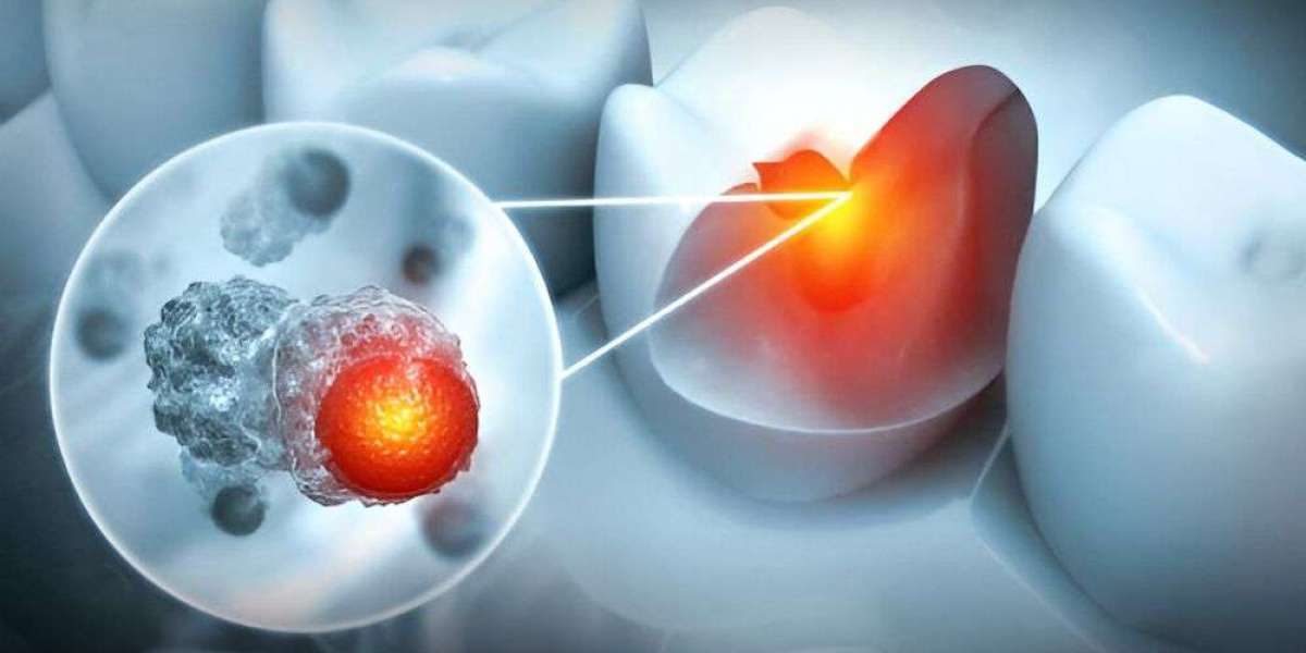 Periodontal Disease Treatment Market Dynamics - Exploring Growth, Opportunities and Technological Advances Up to 2030