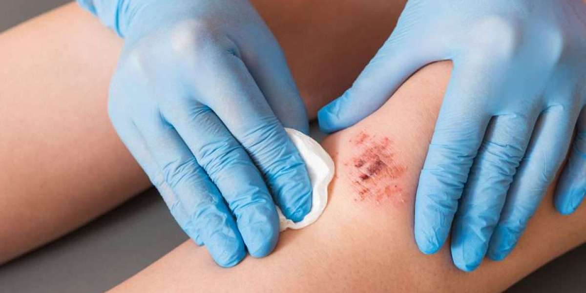 Wound Healing Market | Global Industry Growth, Trends, and Forecast 2023 - 2032