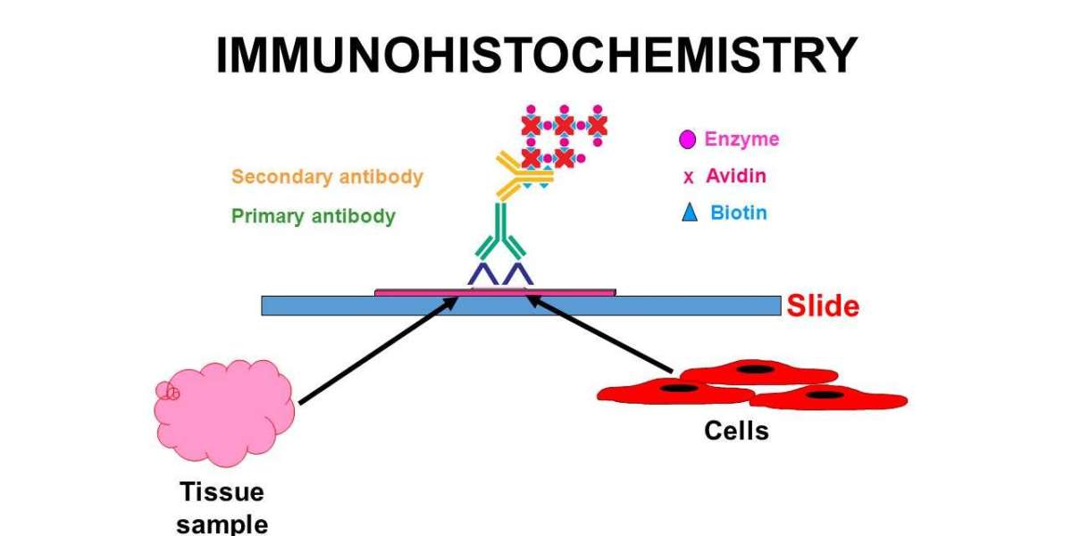 Immunohistochemistry Market Overview Analysis, Trends, Share, Size, Type & Future Forecast to 2034