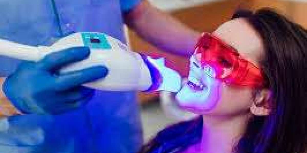 "Why Teeth Whitening Has Become So Popular in Islamabad"