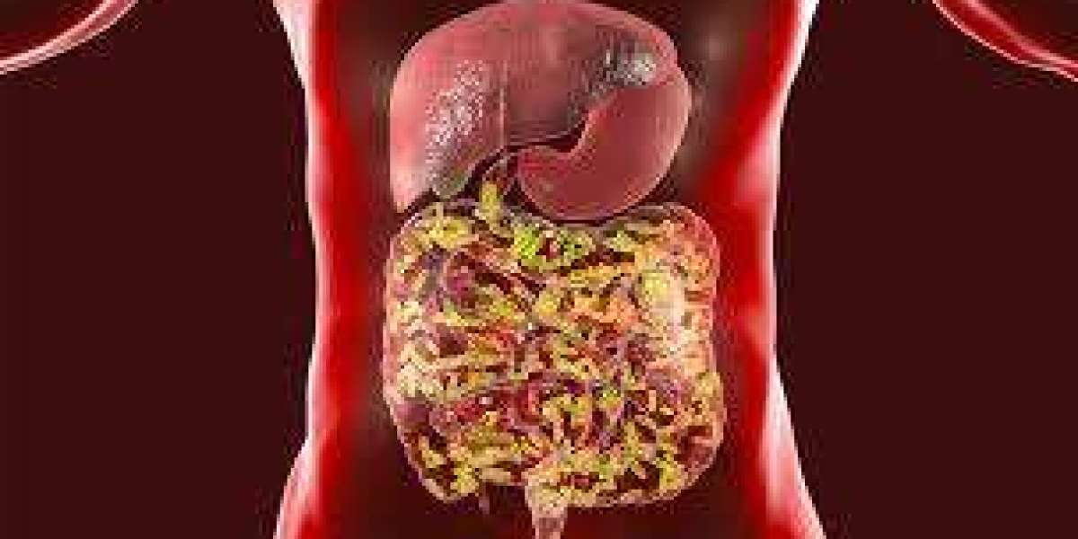 Human Microbiome Market Growth, Share, Opportunities & Competitive Analysis, 2024 – 2032