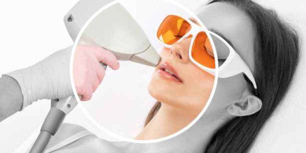 "Permanent Laser Hair Removal: Everything You Need to Know for Long-Lasting Smooth Skin"