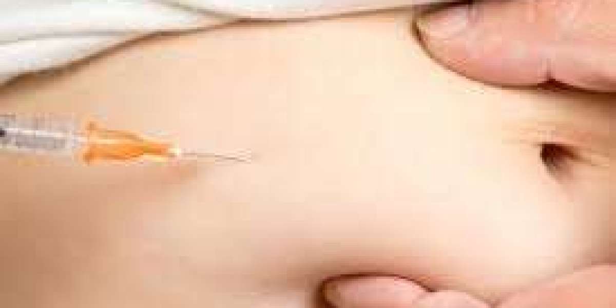 Fat Dissolving Needles in Dubai: Perfect for Your Busy Lifestyle