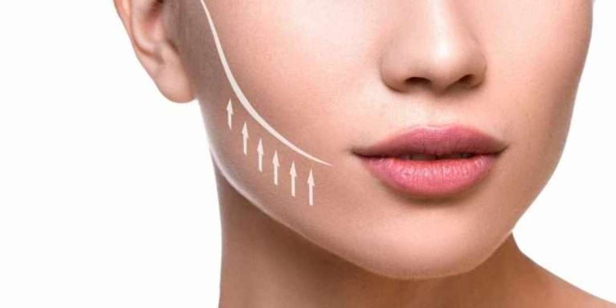 Thread Lift Treatment: Minimally Invasive Skin Tightening