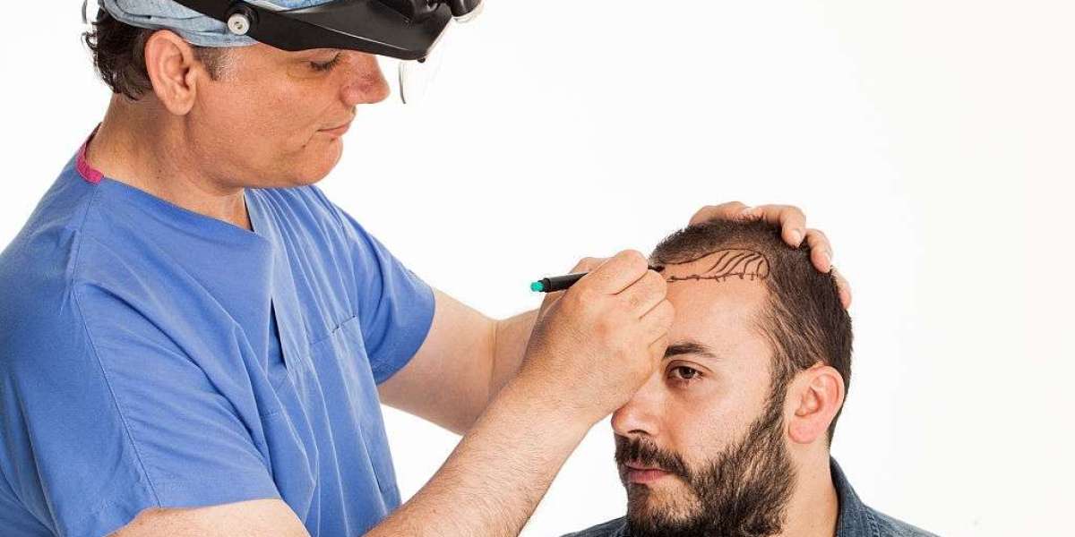 Understanding Robotic Hair Transplants: The Future of Hair Restoration