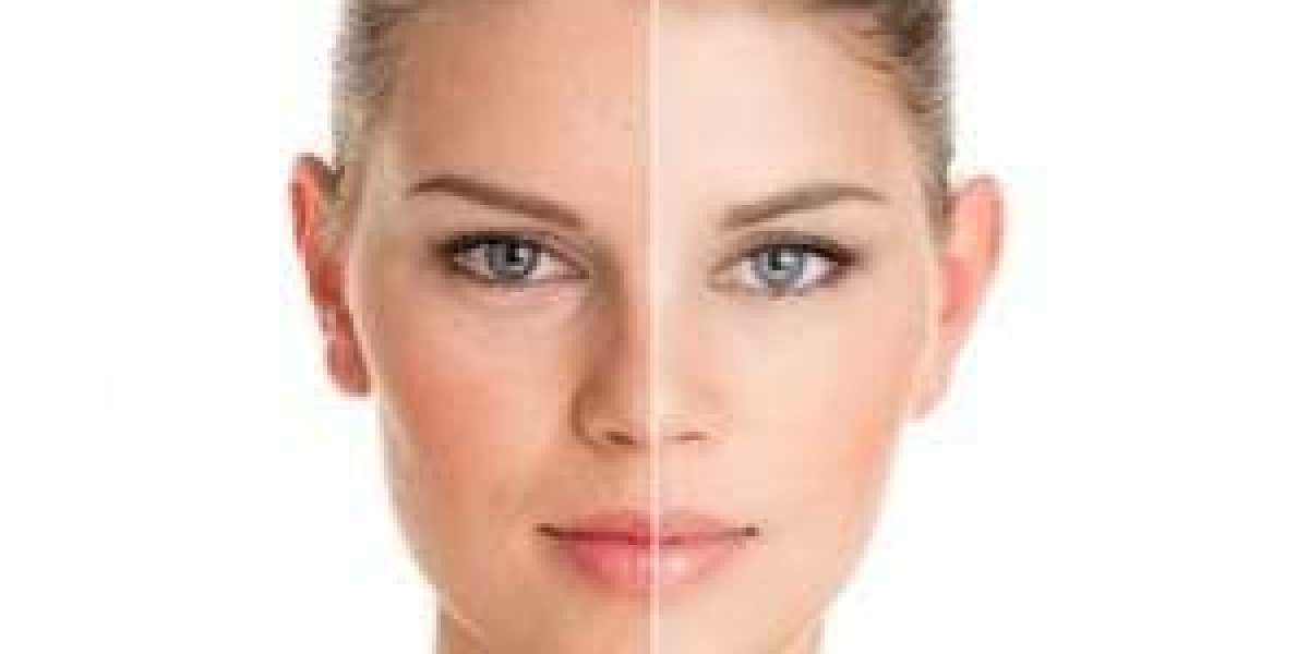 What Is Skin Rejuvenation Unlock the Secret to Radian