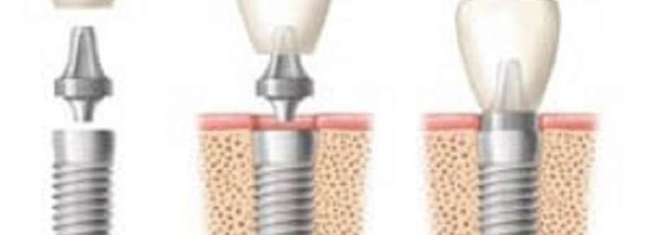 DENTAL IMPLANT PROFESSIONALS Sydney Cover Image