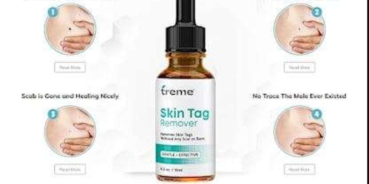 Treme SkinTag Remover: Real Customer Reviews and Before and After Results