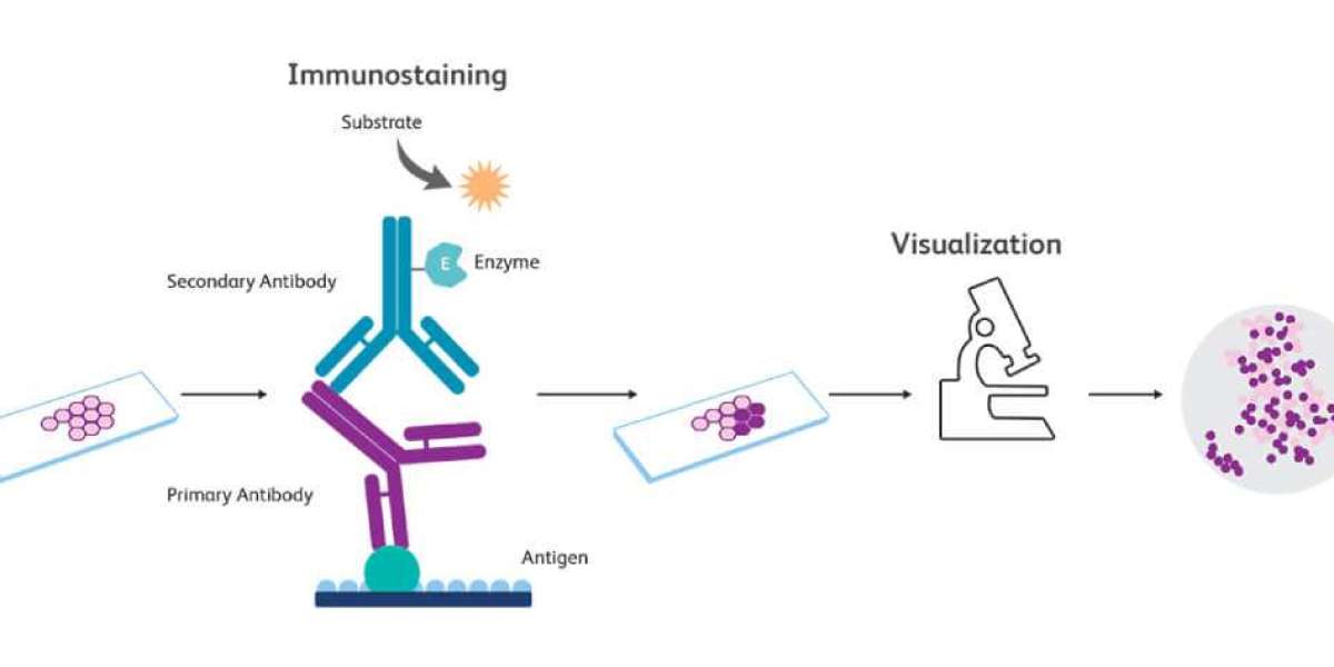 Immunohistochemistry Market Growth and Status Explored in a New Research Report 2034