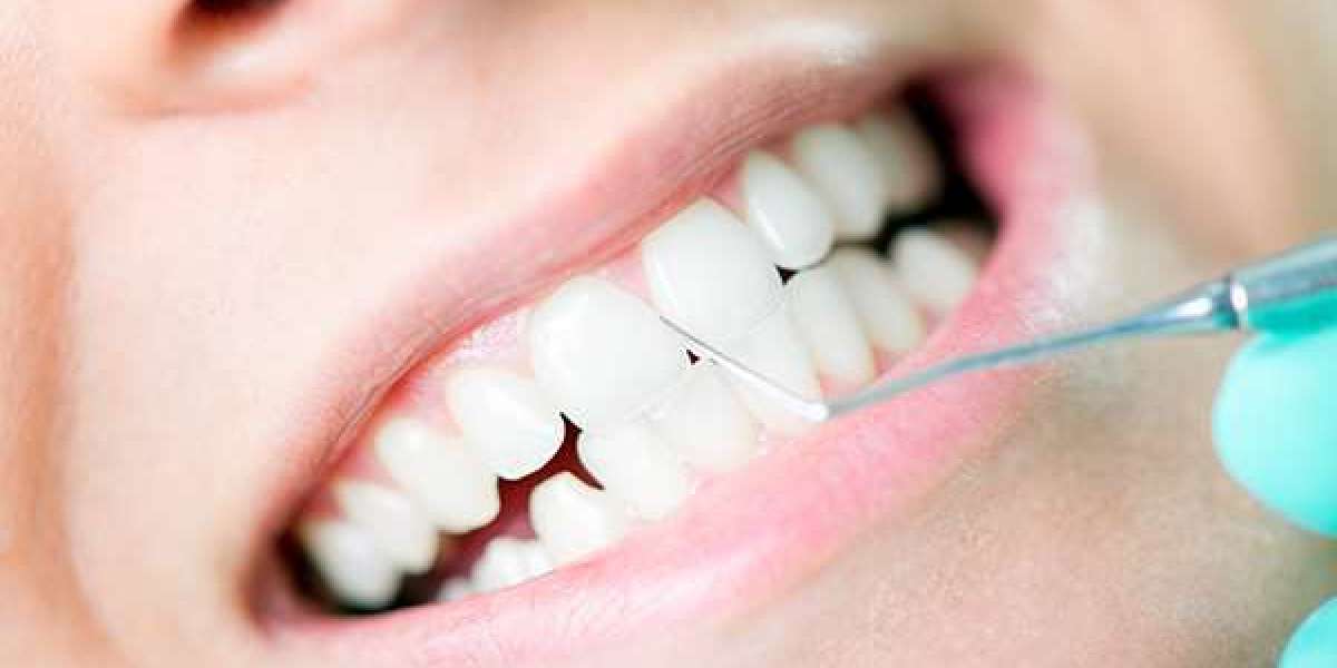 When Is the Right Time for a Professional Teeth Cleaning?