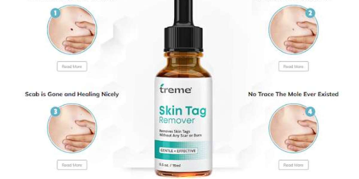 {Latest 2024} Treme Skin: A Safe and Effective Solution For Skin Tag Removal