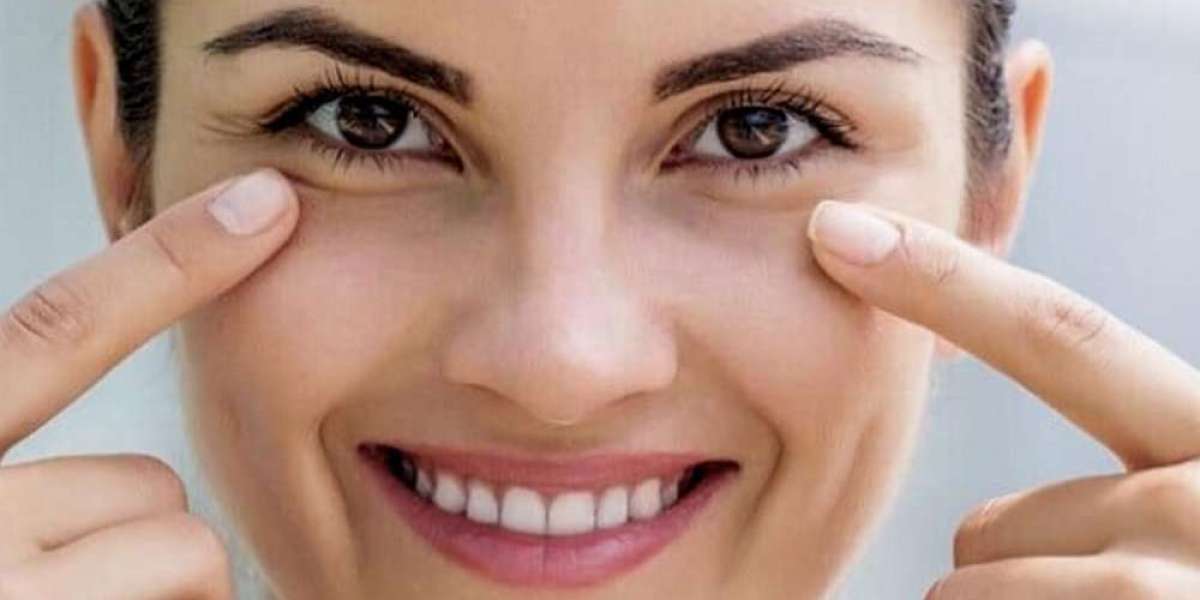 Understanding the Impact of Allergies on Dark Circles