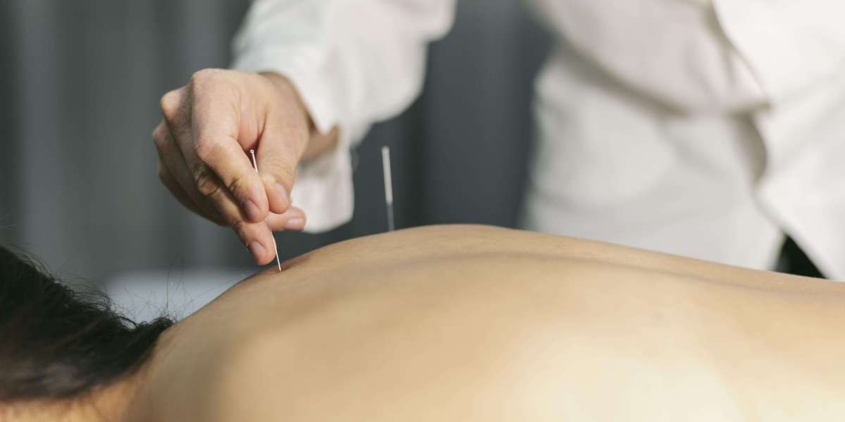 How Acupuncturist in Newport Beach Utilized Ancient Traditions To Cure New Healthcare