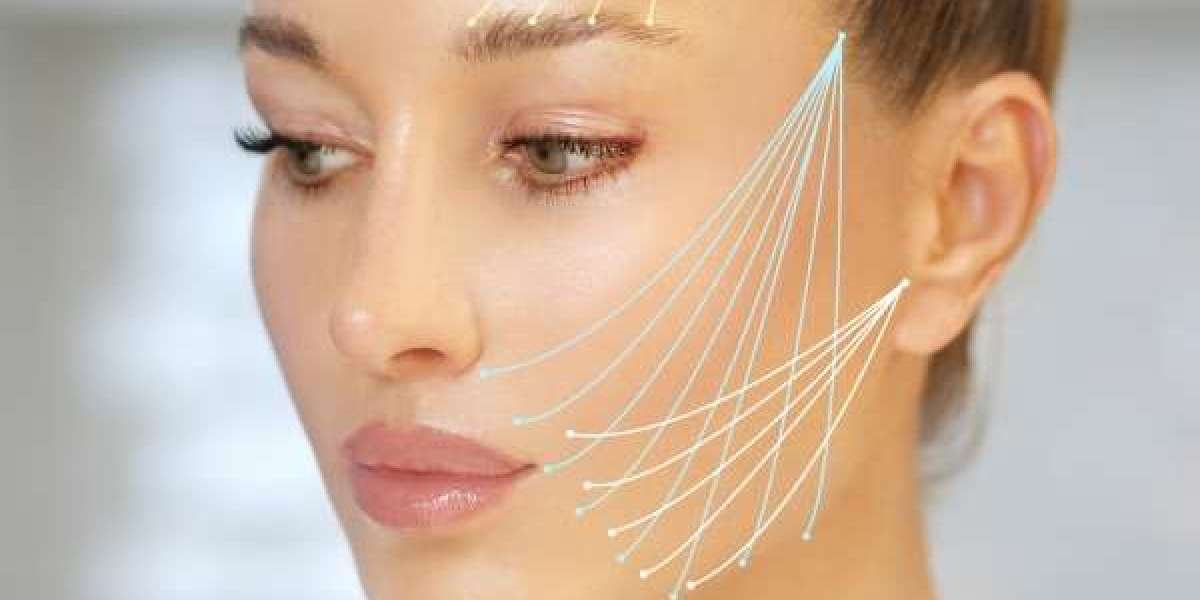 Thread Lift for Wrinkle Reduction: Effective Anti-Aging Solution