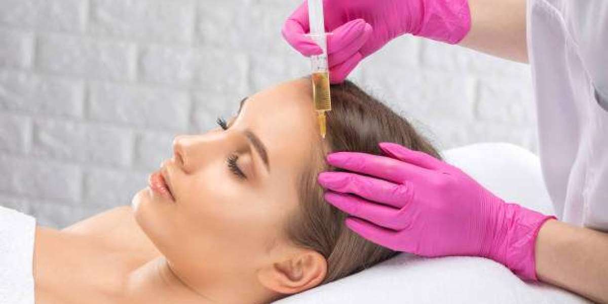 PRP Hair Loss Treatment: A Revolutionary Solution for Thinning Hair