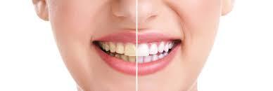 Achieve Your Dream Smile with Cosmetic Dental Services