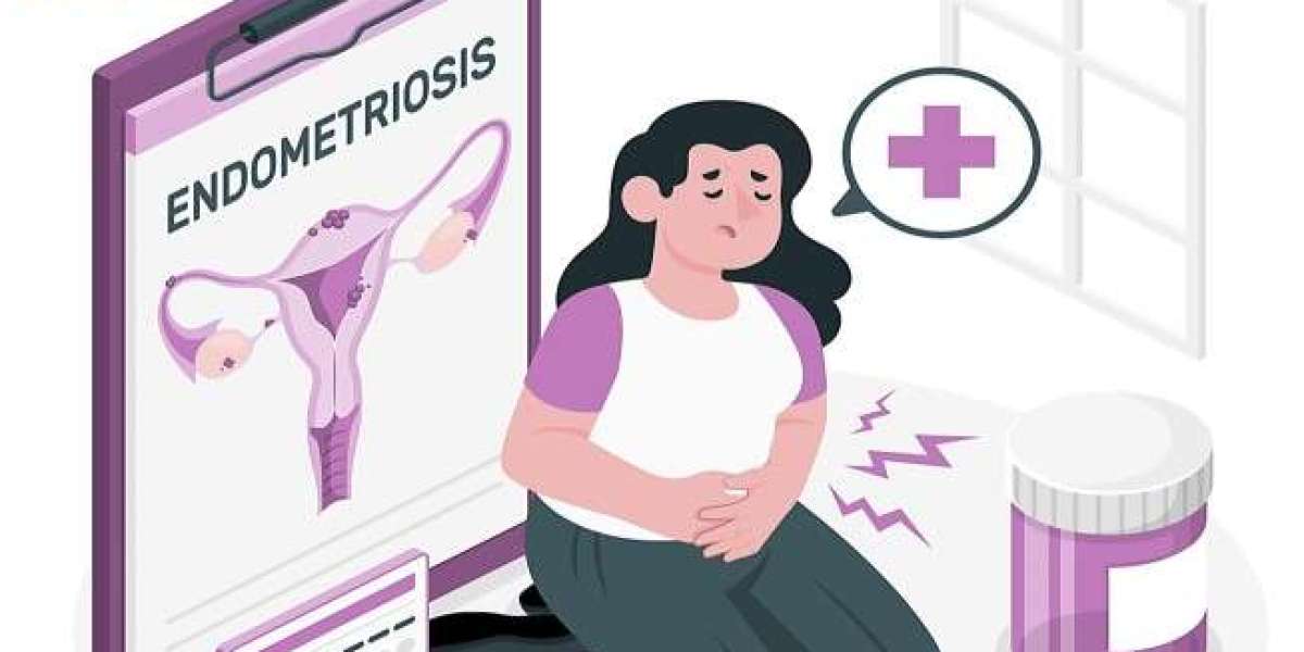 Endometriosis Uncovered: Early Signs, Diagnosis, and Cutting-Edge Treatments