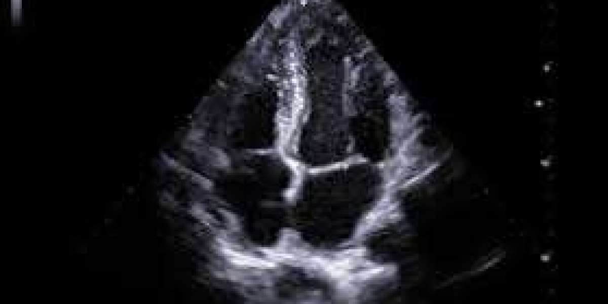 Cardiac Ultrasound Systems Market Growth, Share, Opportunities & Competitive Analysis, 2024 – 2032