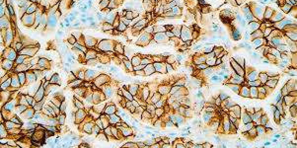 Diagnostic Advancements Propel Immunohistochemistry Market Expansion