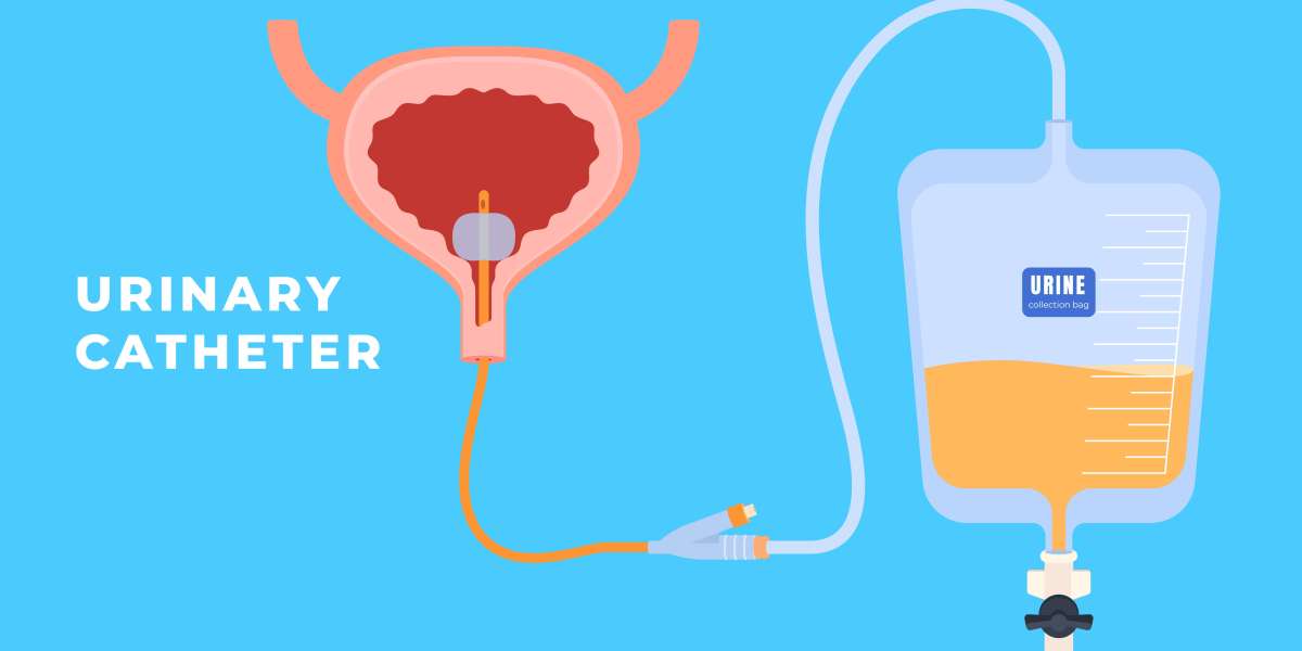 Foley Catheter Bag vs. Leg Bag: Which One Should You Use?