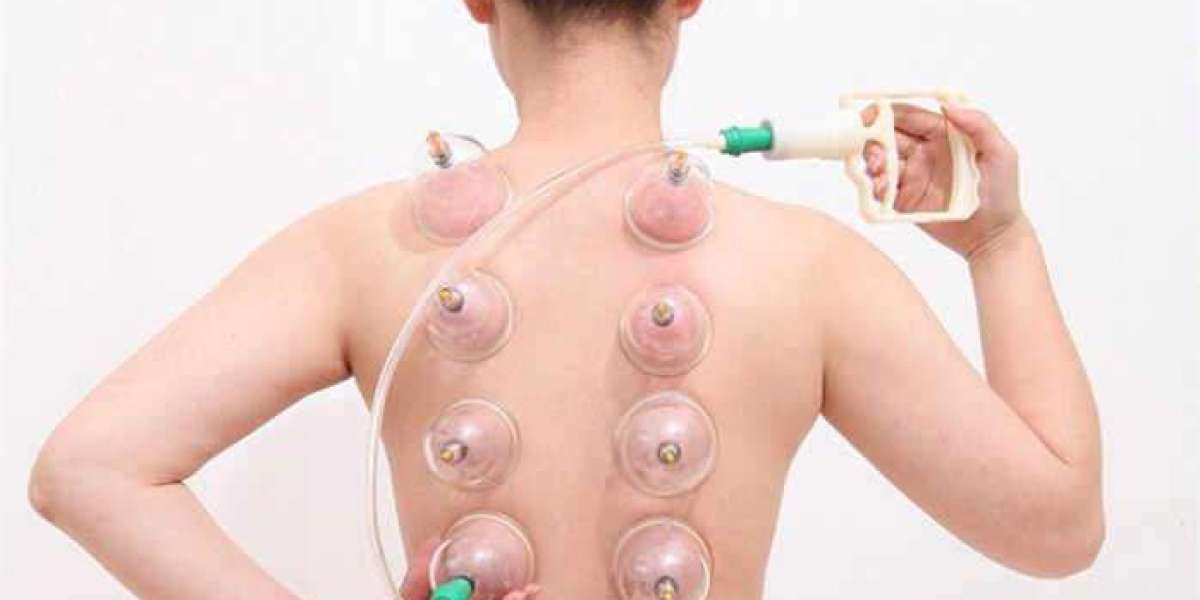 Is Hijama Cupping Therapy Suitable for the Elderly?