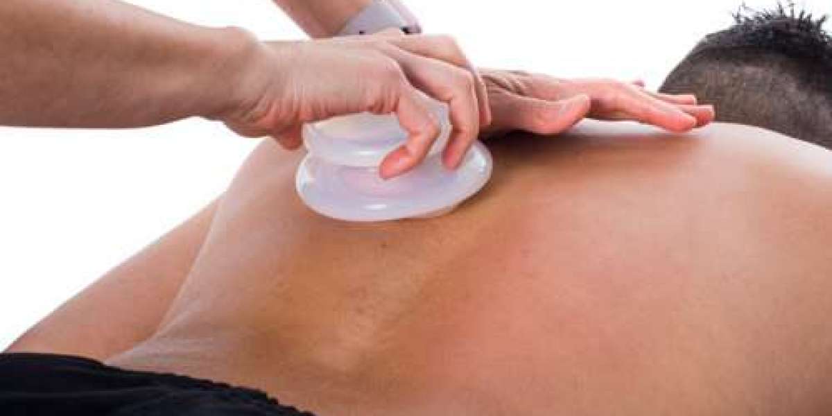 Is Hijama Cupping Therapy a Long-Term Health Solution?