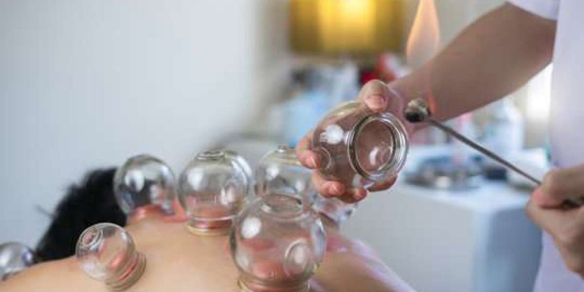 Is Hijama Cupping Therapy Good for Detoxification?