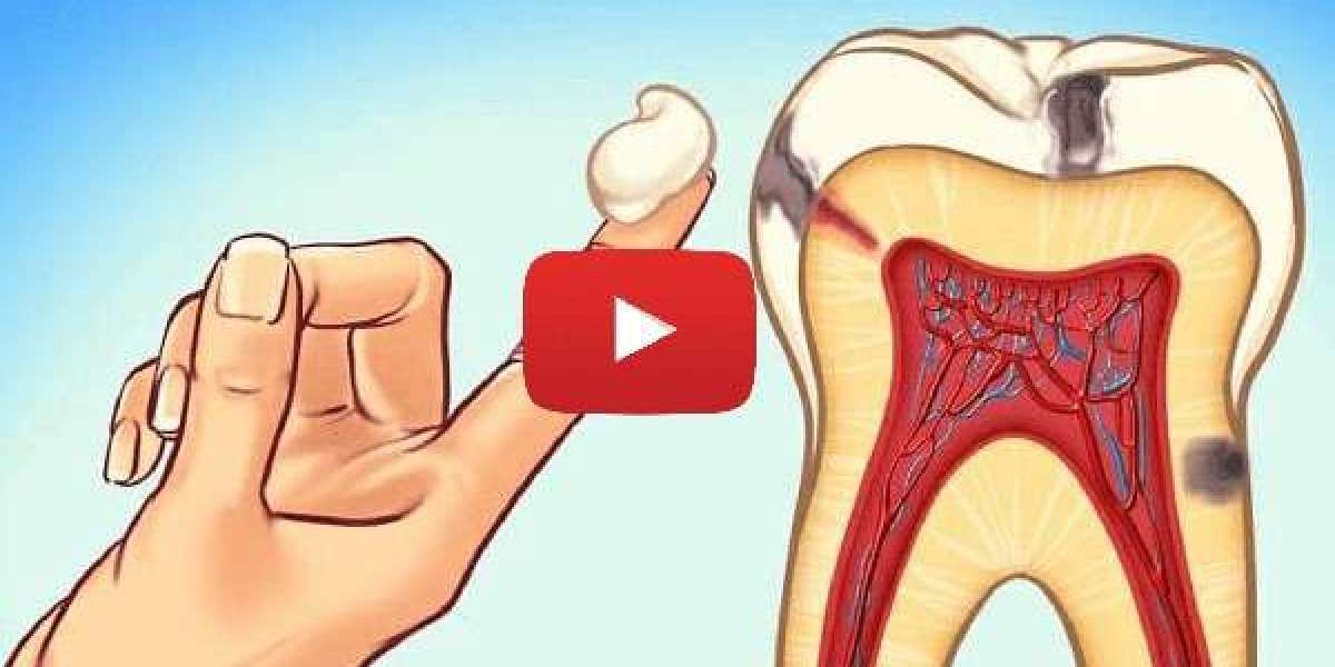 Fresh Breath 101: Effective Remedies for Banishing Bad Breath