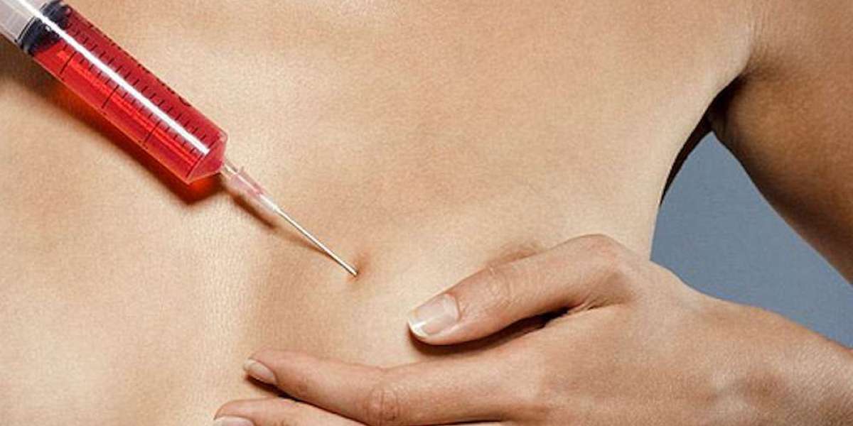 What Are Breast Augmentation Injections? Everything You Need to Know
