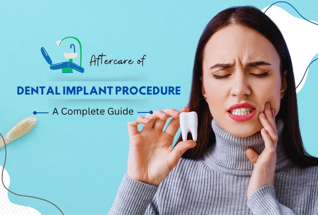 Aftercare of Dental Implant Procedure: A Complete Guide | Teethcare