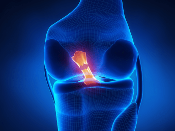 Best ACL Surgeon & Ligament Surgery Specialist In Ranchi
