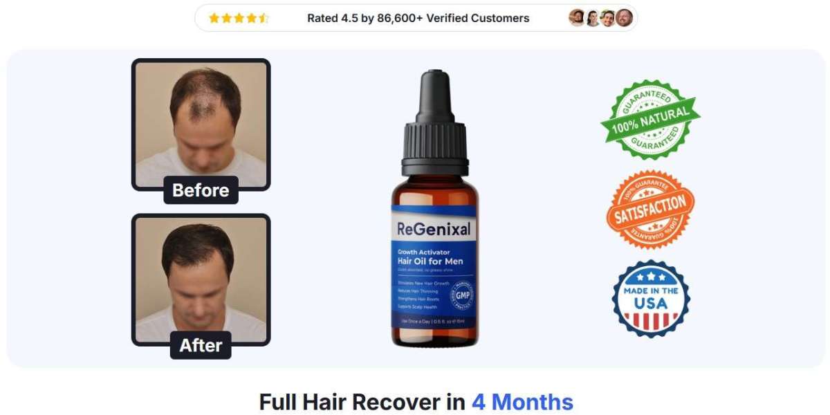 Regenixal Hair Regrowth: Is it Protected to Utilize?
