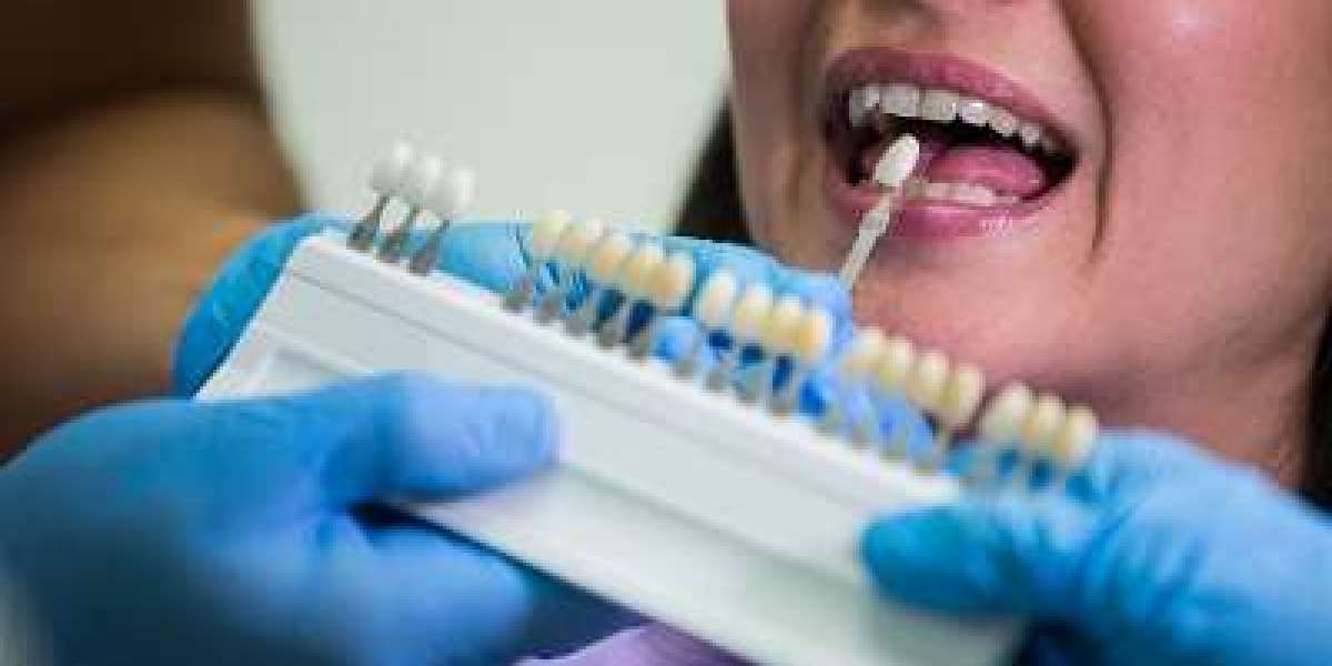 Affordable Dental Care on the Sunshine Coast: Where Quality Meets Value