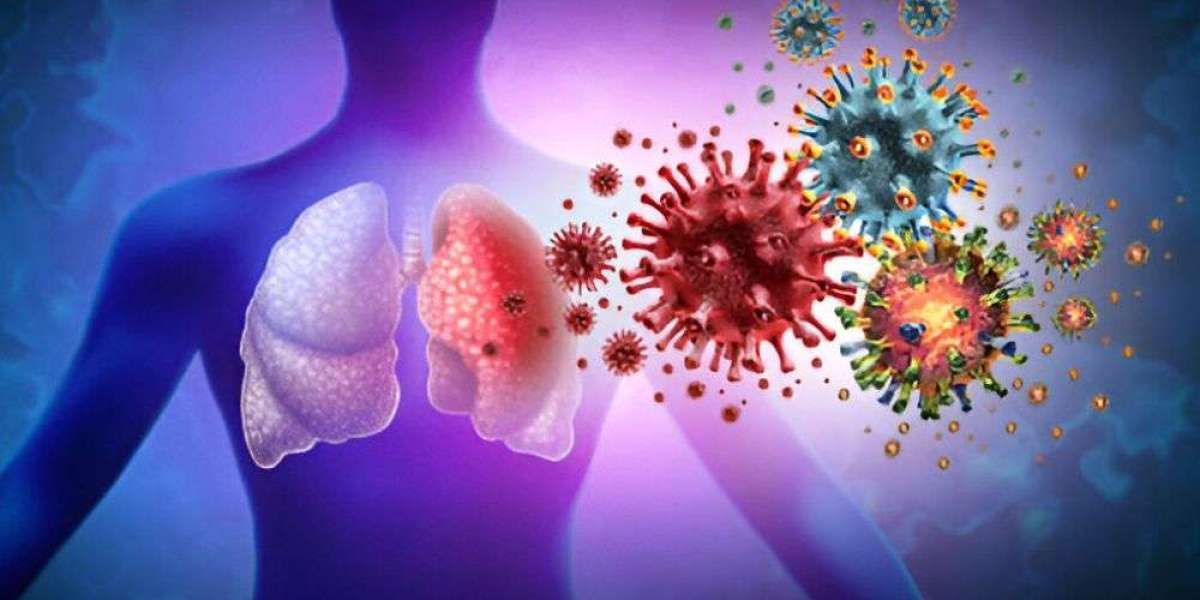 Respiratory Syncytial Virus (RSV) Diagnostic Market In-depth Insights, Revenue Details and Regional Analysis by 2030