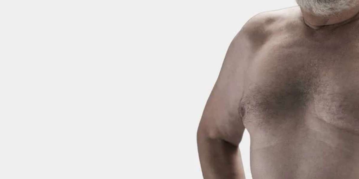 Considering gynecomastia surgery? Here are 5 things that you should know