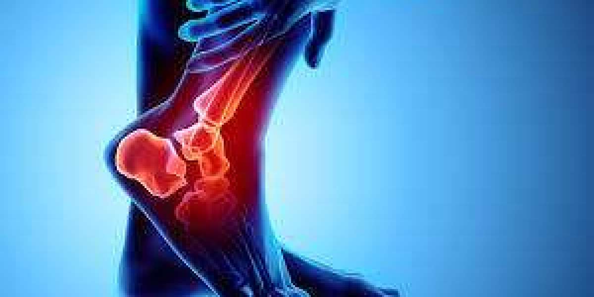 How Effective Is Celebrex 200mg for Chronic Pain?