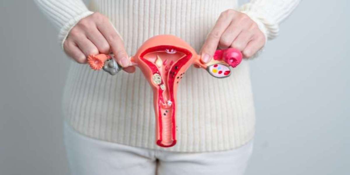 How to Choose the Right Fibroid Embolization Specialist for Your Needs