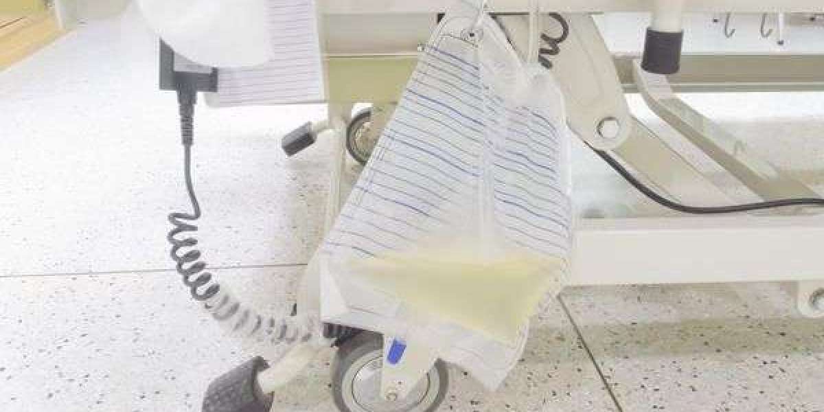Why is Accurate Urine Sample Collection a Must?