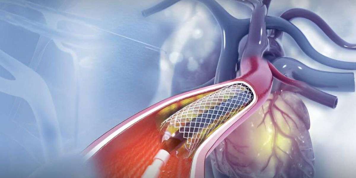 Interventional Cardiology Devices Market Analysis Distribution, End-Users, Growth Factors, Competitive Landscape and For