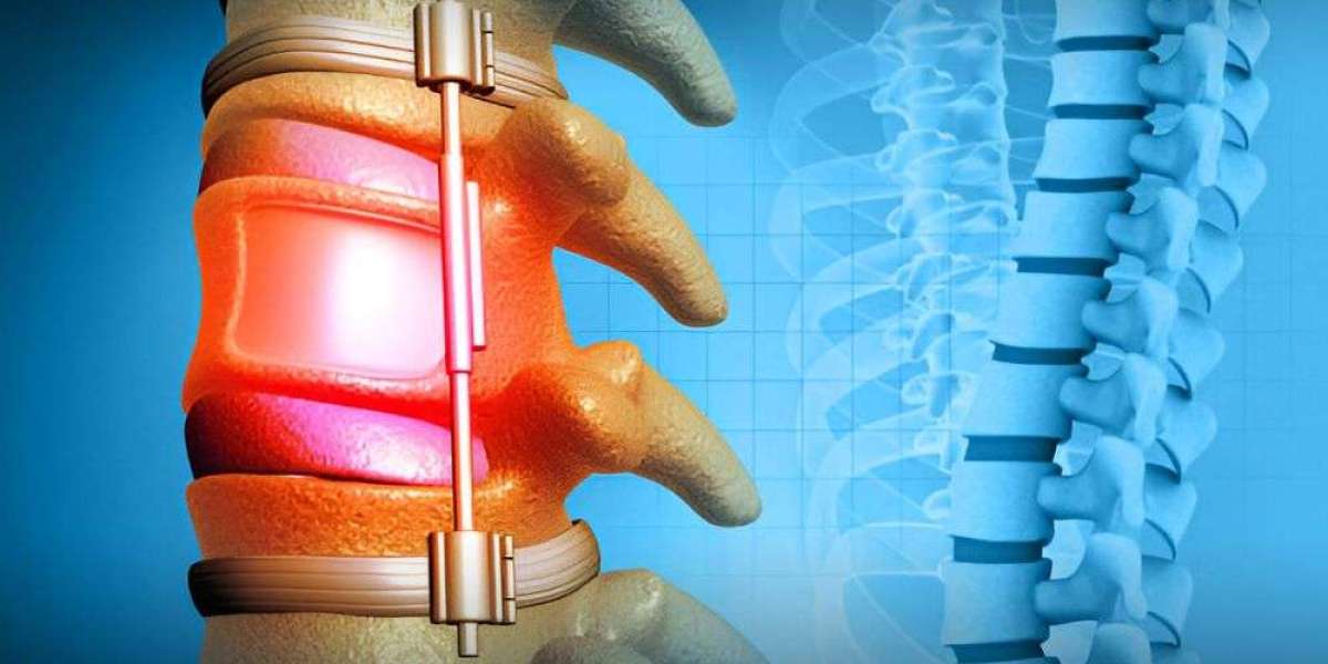 Orthopedic Fixation Market Offering New Industry Trends, Growing Opportunities and Innovations by 2030